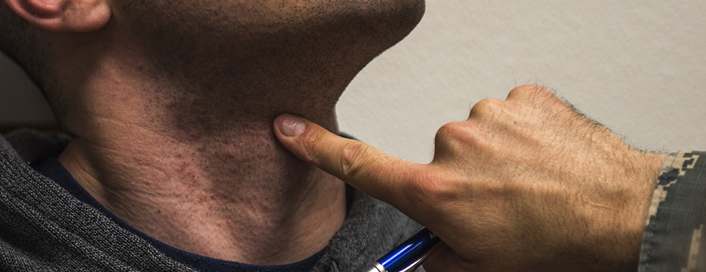 Local Airmen requesting shaving waivers must make appointments at JBSA-Lackland, JBSA-Randolph